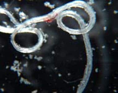 Figure A: Adult of <em>L. loa</em> removed from the eye of a patient. Image courtesy of the Georgia State Public Health Laboratory.
