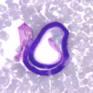 Figure B: Microfilaria of <em>B. malayi</em> in a thin blood smear, stained with Giemsa.