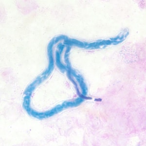 Figure C: Microfilaria of <em>M. perstans</em> in a thick blood smear stained with Giemsa, from a patient from Cameroon.