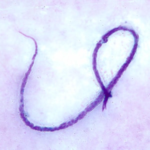 Figure C: Microfilaria of <em>M. ozzardi</em> in a thick blood smears, stained with Giemsa.