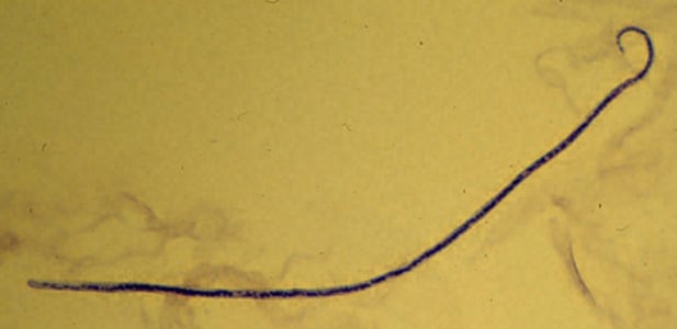 Figure A: Microfilaria of <em>M. streptocerca</em>, fixed in 2% formalin and stained with hematoxylin.