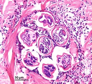 Figure B: Closer view of the coiled female <em>M. streptocerca</em> in Figure A. Note the microfilariae within the uterine tubes.  