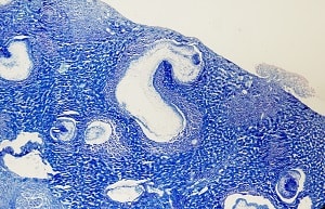 Figure D: Multiple tetrathyridia visible in a liver section from an experimentally-infected mouse. 40x magnification.