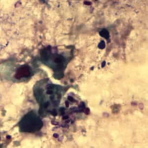 Figure B: <em>Encephalitozoon cuniculi</em> spores stained with Gram Chromotrope.