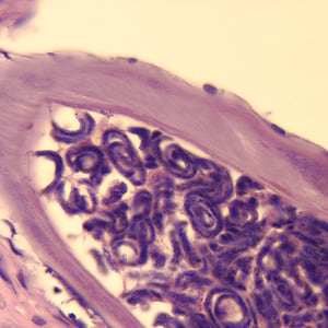 Figure E: Cross-section of an adult female <em>O. volvulus</em>, stained with H&E. Note the presence of many microfilariae within the uterus.