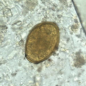 Figure B: Egg of <em>P. westermani</em> in an unstained wet mount.