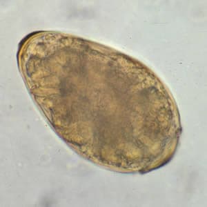 Figure A: Egg of <em>P. westermani</em> in an unstained wet mount.
