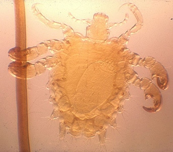 Figure A: Adult female <em>P. pubis</em>. An egg can be seen within her body cavity.