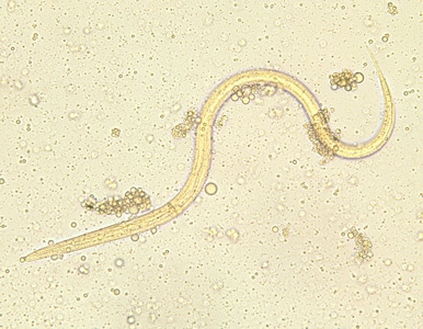 Figure A: Filariform (L3) larva of <em>S. stercoralis</em> in an unstained wet mount. 