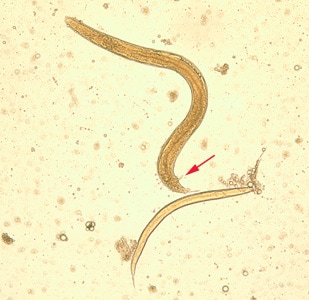 Figure B: Free living adult male <em>S. stercoralis</em>, showing a spicule (red arrow). A smaller, rhabditiform larva lies adjacent to the adult male. 