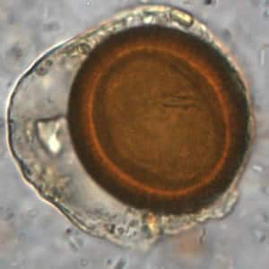 Figure D: Iodine-stained wet mount of a <em>Taenia</em> sp. egg. Image courtesy of the Oregon State Public Health Laboratory.