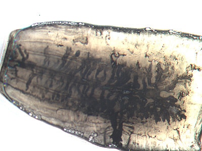 Figure B: Mature proglottid of <em>T. saginata</em>, stained with India ink. Note the number of primary uterine branches (>12). Image courtesy of the Orange County Public Health Laboratory, Santa Ana, CA.