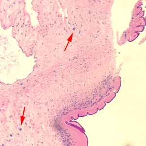 Figure A: Cross-section of a proglottid of <em>Taenia</em> sp., stained with H&E. Note the thick outer tegument and the loose parenchyma filling the body. Calcareous corpuscles (red arrows), characteristic of the cestodes, can be seen in the parenchyma. Image courtesy of the Washington State Public Health Laboratories.