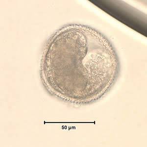 Figure A: <em>Toxocara</em> sp. egg teased from an adult worm. The worm was never identified, but the egg size is most consistent with T. cati. Image courtesy of the New Jersey State Public Health Laboratory.