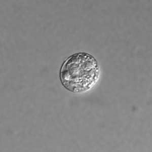 Figure B: Unsporulated oocyst of <em>T. gondii</em> in an unstained wet mount, viewed with differential interference contrast (DIC) microscopy.