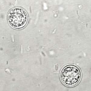 Figure A: Unsporulated <em>T. gondii</em> oocyst in an unstained wet mount.