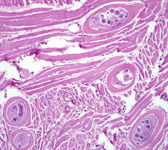Figure A: Encysted larvae of <em>Trichinella</em> sp. in muscle tissue, stained with hematoxylin and eosin (H&E). The image magnification is 200x.