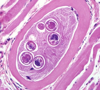 Figure C: Encysted larvae of <em>Trichinella</em> sp. in muscle tissue, stained with hematoxylin and eosin (H&E). Image was captured at 400x magnification.