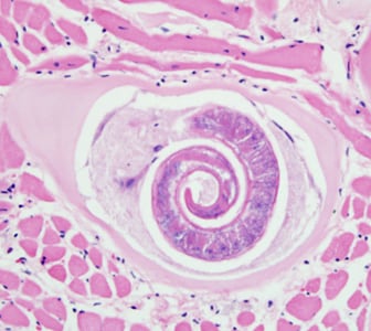 Figure A: <em>Trichinella</em> larva in tongue muscle of a rat, stained with hematoxylin and eosin (H&E). Image was captured at 400x magnification.