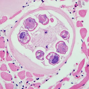 Figure B: <em>Trichinella</em> larva in tongue muscle of a rat, stained with hematoxylin and eosin (H&E). Image was captured at 400x magnification.