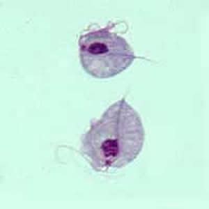 Figure A: Two trophozoites of <em>T. vaginalis</em> obtained from in vitro culture, stained with Giemsa.