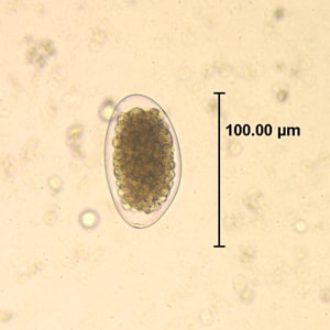 Figure A: Egg of <em>Trichostrongylus</em> sp. in an unstained wet mount of stool.