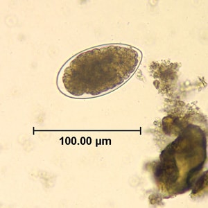 Figure B: Egg of <em>Trichostrongylus</em> sp. in an unstained wet mount of stool.