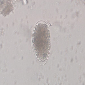 Figure C: Egg of <em>Trichostrongylus</em> sp. in an unstained wet mount of stool. Image courtesy of the Indiana State Department of Health.