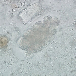 Figure D: Egg of <em>Trichostrongylus</em> sp. in an unstained wet mount of stool. Image courtesy of the Indiana State Department of Health.