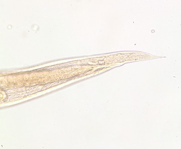 Figure B: Posterior end of the same specimen as Figure A. Note the pointed tail. Image taken at 200x magnification.