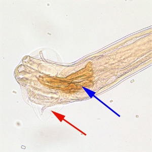 Figure D: Posterior end of a male <em>Trichostrongylus</em> sp. Note the presence of a bursa (red arrow) and spicule (blue arrow). of a glycerin-mounted specimen, taken at 200x magnification.