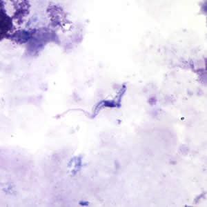 Figure A: <em>Trypansoma brucei</em> ssp. in a thick blood smear stained with Giemsa.