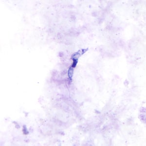 Figure C: <em>Trypansoma brucei</em> ssp. in a thick blood smear stained with Giemsa.
