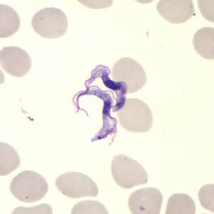 Figure B: <em>Trypanosoma brucei</em> ssp. in a thin blood smear stained with Giemsa.