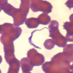Figure B: <em>Trypanosoma brucei</em> ssp. in a thin blood smear stained with Wright-Giemsa.