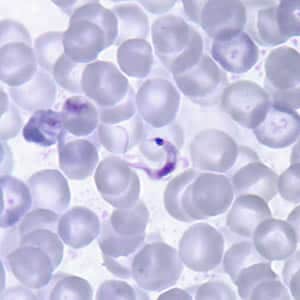 Figure A: <em>T. cruzi</em> trypomastigote in a thin blood smear stained with Giemsa. Note the typical C-shape of the trypomastigote that characterizes T. cruzi in fixed blood smears.