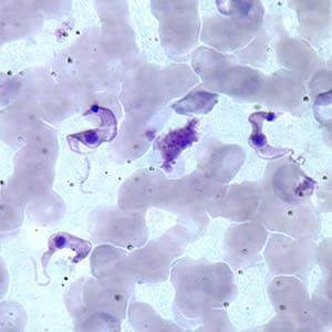 Figure B: Three <em>T. cruzi</em> trypomastigotes in a thin blood smear stained with Giemsa.
