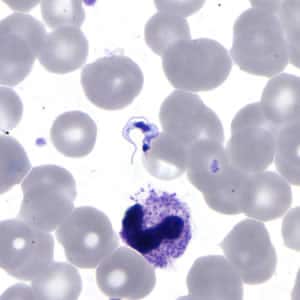 Figure C: <em>T. cruzi</em> trypomastigote in a thin blood smear stained with Giemsa.