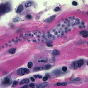 Figure A: <em>Trypanosoma cruzi</em> amastigotes in heart tissue. The section is stained with hematoxylin and eosin (H&E).