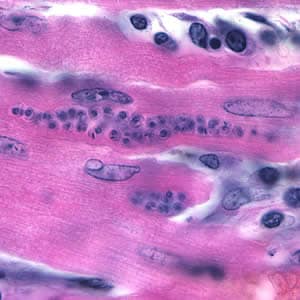 Figure C: <em>Trypanosoma cruzi</em> amastigotes in heart tissue. The section is stained with H&E.