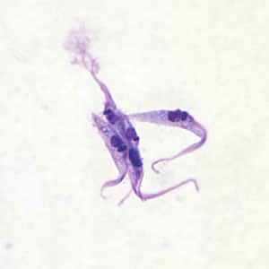 Figure B: <em>Trypanosoma cruzi</em> epimastigotes from culture. Note the location of the kinetoplast anterior to the nucleus.