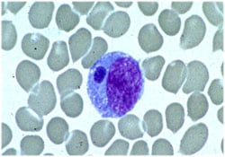 ehrlichia ehrlichiosis monocyte smear blood anaplasma cdc peripheral symptoms detected infection microscopic wbc monocytes inclusion phagocytophilum diagnosis treatment associated figure