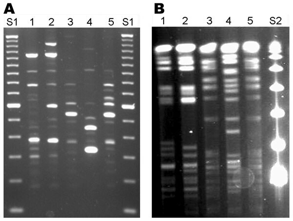 Repetitive element (Rep)–PCR (A) and pulsed-field gel electrophoresis (PFGE) (B) patterns of Mycobacterium cosmeticum isolates from 2 patients in Ohio and 1 patient in Venezuela. Rep-PCR was performed by using BOXA1R primer (3), and PFGE was performed with restriction enzyme AseI. Lanes 1, 2, Ohio isolates OH1 and OH2; lanes 3, 4, control strains ATCC BAA-878T and ATCC BAA-879; lane 5, Venezuelan isolate VZ1. DNA size standards are 100-bp (S1) and 48.5-kb marker (S2).
