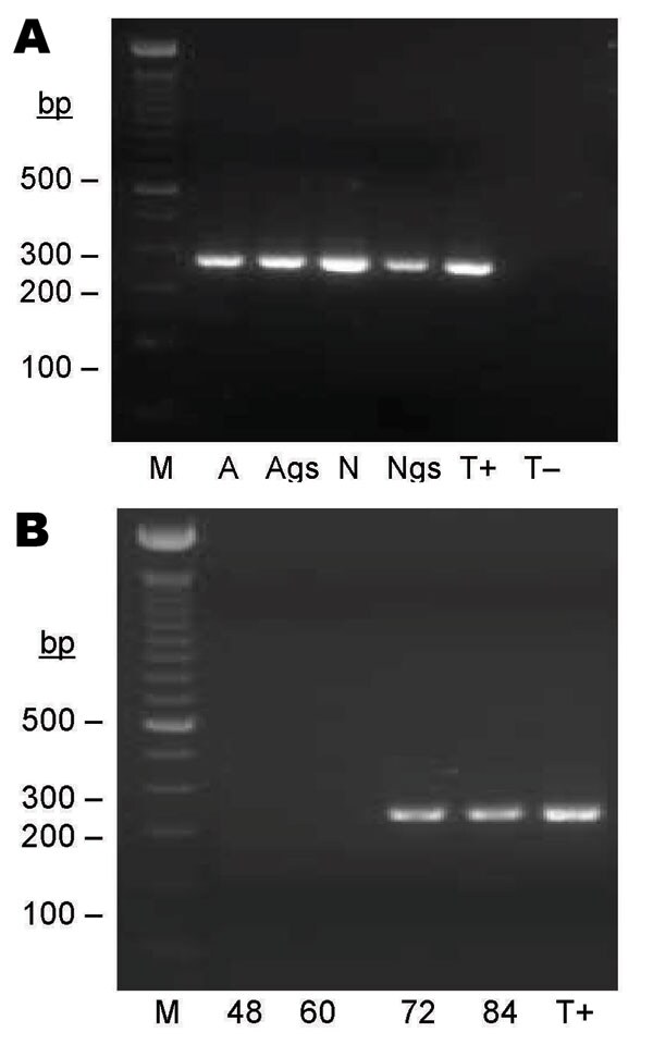 Seminested PCR detection of Bartonella spp. DNA after partial refeeding of infected ticks. A) Bartonella spp. DNA detection in Ixodes ricinus ticks fed on B. henselae–infected blood at previous development stages and refed for 84 h on uninfected blood. Lane M, 100-bp DNA molecular mass; lane A, carcass of female adult; lane Ags, salivary glands of female adult, lane N, carcass of nymph; lane Ngs, salivary glands of nymph; lane T+, B. bacilliformis DNA; lane T–, nymph fed on uninfected ovine blood. B) Bartonella spp. DNA detection in blood isolated from feeders. Lane M, 100-bp DNA molecular mass marker; lane 48, ovine blood after 48 h of tick attachment on skin; lane 60, ovine blood after 60 h of tick attachment on skin; lane 72, ovine blood after 72 h of tick attachment on skin; lane 84, ovine blood after 84 h of tick attachment on skin; lane T+, B. bacilliformis DNA.