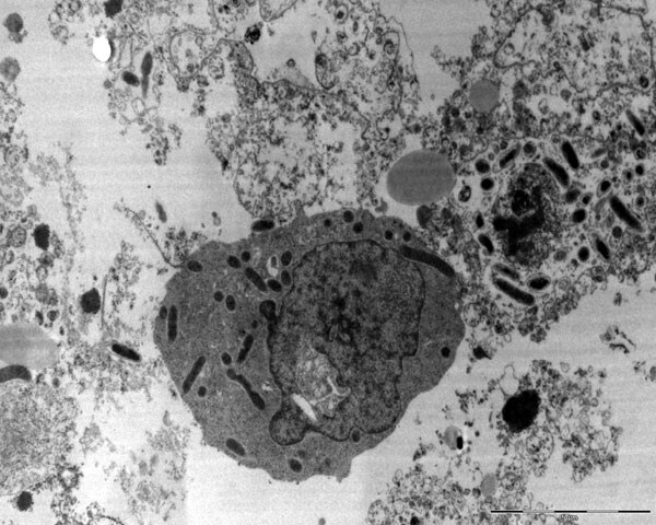 Rickettsia conorii conorii localized in cytoplasm of host cells as seen by electron microscopy (magnification ×100,000).