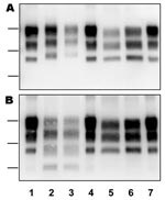 Thumbnail of Representative Western blot analyses of protease-resistant prion protein (PrPres) in H-type (lanes 2, 3), L-type (lanes 5, 6), and C-type (lanes 1, 4, 7) cases of bovine spongiform encephalopathy (BSE). Bars to the left of the panels indicate the 29.0-, 20.1-, and 14.3-kDa marker positions. H-type, higher molecular masses of unglycosylated PrPres; L-type, lower molecular masses of unglycosylated PrPres; C-type, classic BSE. Monoclonal antibodies Sha31 and SAF84 were used for PrPres detection in panels A and B, respectively.