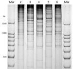 Thumbnail of Direct genome restriction enzyme analysis with NaeI of clinical isolates of Vibrio parahaemolyticus representative of the 5 patterns observed during the outbreaks in Puerto Montt, Chile, January and February, 2007. Lanes MW, 100-bp size ladder; lane 2, PMC38.7; lane 3, PMC60.7; lane 4, PMC53.7; lane 5, PMC75.7; lane 6, VpKX. (O3:K6 pandemic isolate).