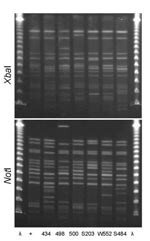 Thumbnail of XbaI and NotI pulsed-field gel electrophoresis patterns for clonal group A Escherichia coli isolated from women with urinary tract infections in Montréal, Québec, Canada, 2006 (lanes 434 and 498) and Berkeley, California, USA, 1999–2001 (lanes 500, S203, W552, and S484). Antimicrobial drug resistance phenotypes and serogroups (O11, O17, O77, and O73) varied within and between the 2 study locations. First and last lanes, bacteriophage λ; lane +, positive control.