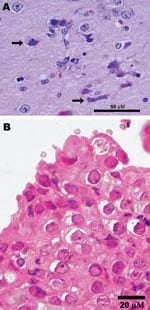 Thumbnail of Photomicrographs showing A) encephalitis with neuronal necrosis and intranuclear inclusions (arrows) in a polar bear (Ursus maritimus); scale bar = 50 μm; hematoxylin and eosin stain; and B) Grevy’s zebra (Equus grevysi) with acute rhinitis with eosinophilic inclusions in respiratory epithelium; scale bar = 20 μm; hematoxylin and eosin stain.