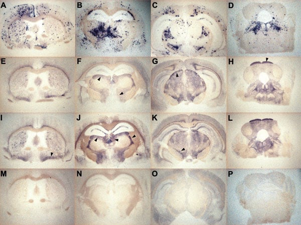 Representative histoblots in 4 different anteroposterior sections showing the distribution of disease-specific PrPres deposits in the brains of tg650 mice infected with bovine spongiform encephalopathy (BSE) or L-type BSE. Panels A–D show infection with BSE (second passage of France 3). Panels E–H show infection with L-type BSE (first passage of France 7). Panels I–L show infection with L-type BSE (second passage of Italy). Panels M–P show brain sections of an age-matched, mock-infected mouse, euthanized while healthy at 700 days postinfection, for comparison. Note the differing aspect and distribution of PrPres deposits between brain of mice infected with BSE and BSE-L (arrowheads). Assignment of the positive brain regions has been made according to a mouse brain atlas after digital acquisition.